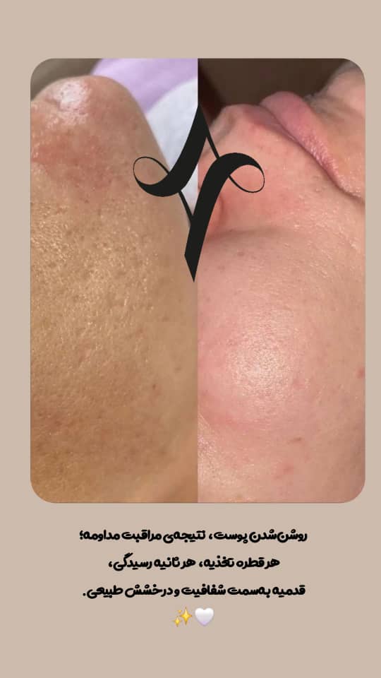 خدمات پاکسازی و درمان پوست یلدا اکبری در شیراز